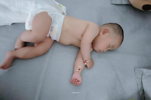 永安六个月宝宝眼睛散光